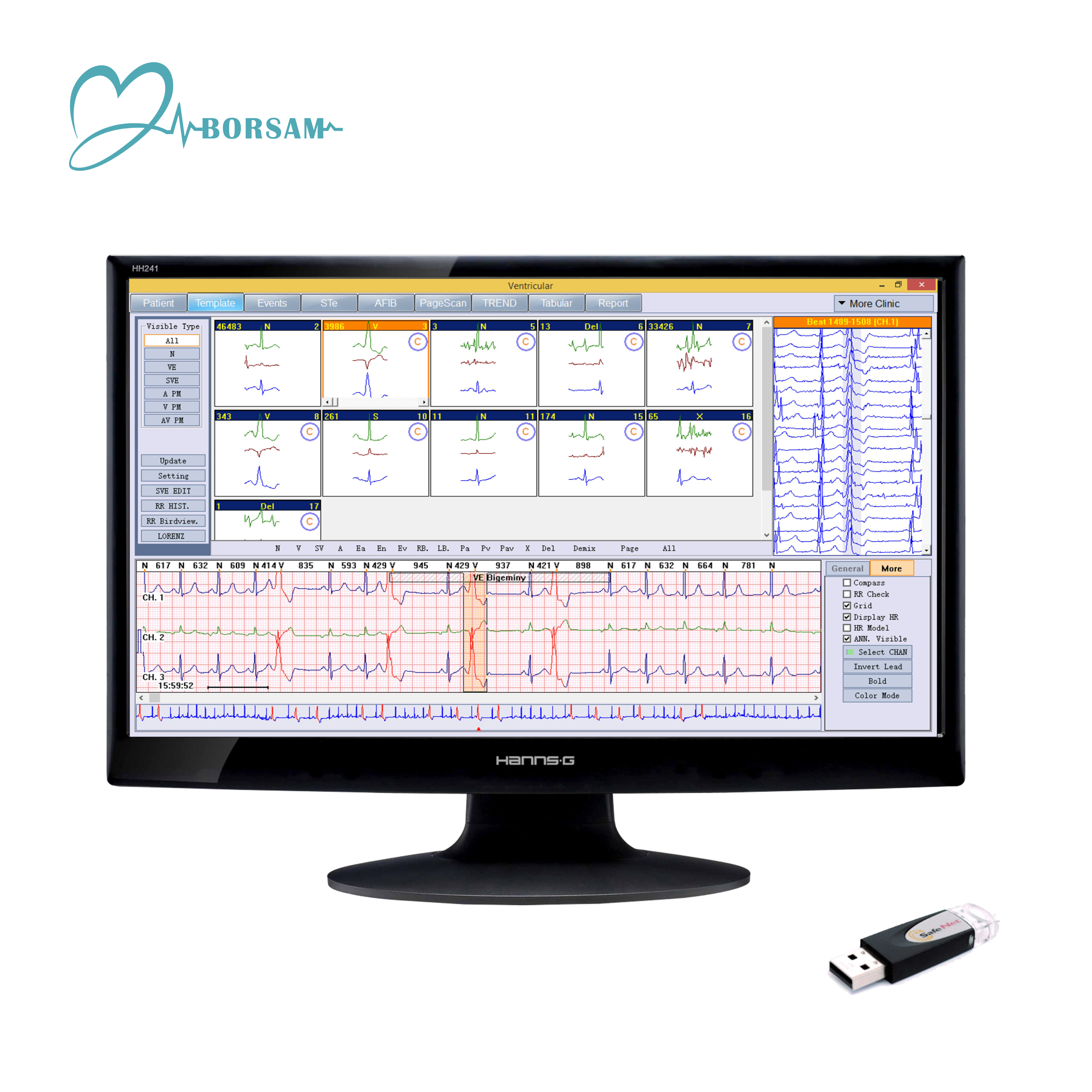 Cardioscan Ipad 12-lead 12 Channel Holter ECG Monitoring System Software