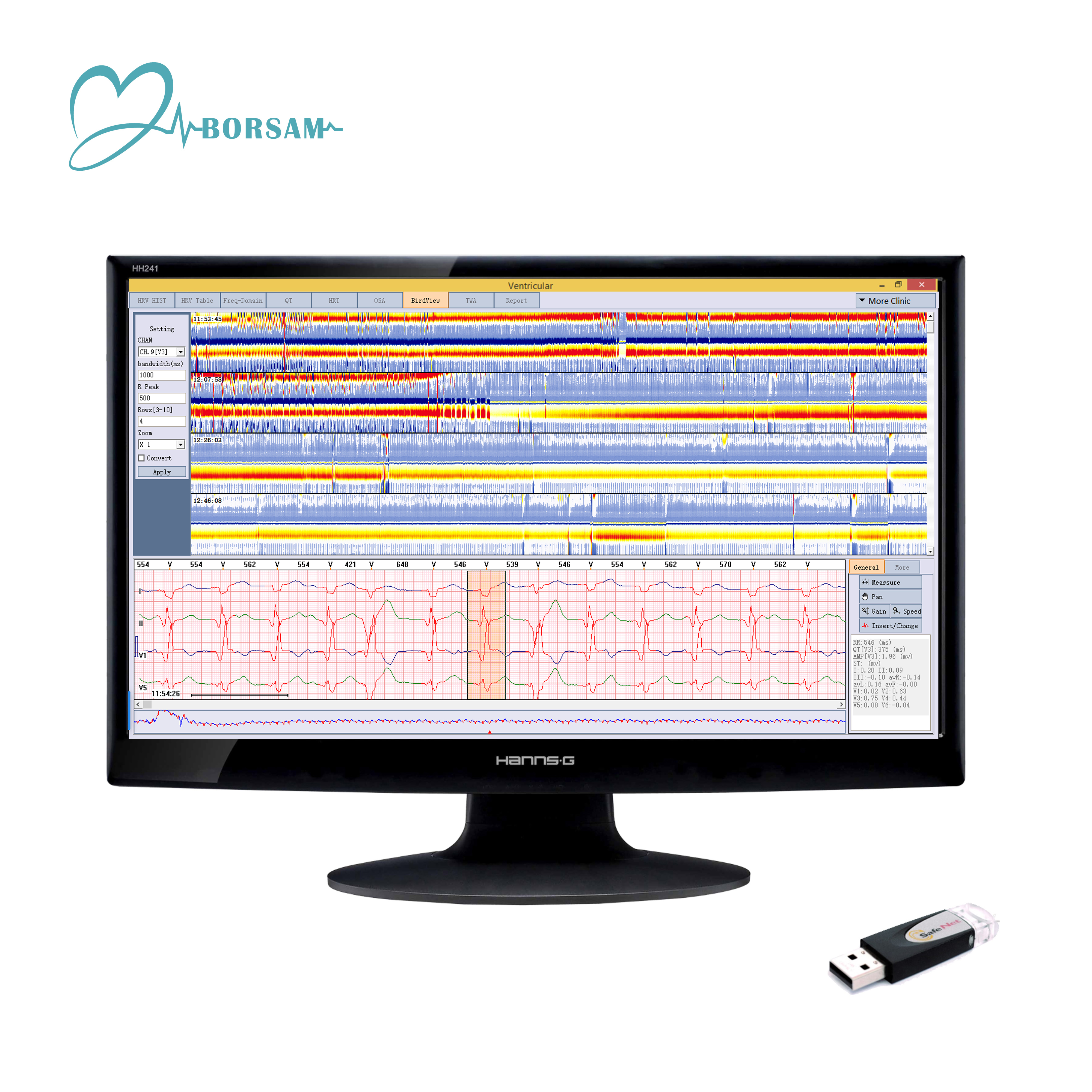 Dynamic Cardioscan Holter ECG Analysis Software