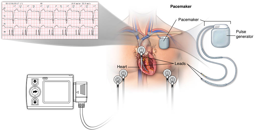 Professional Mini Holter 3 Lead ECG Cable Holter Device with Clips