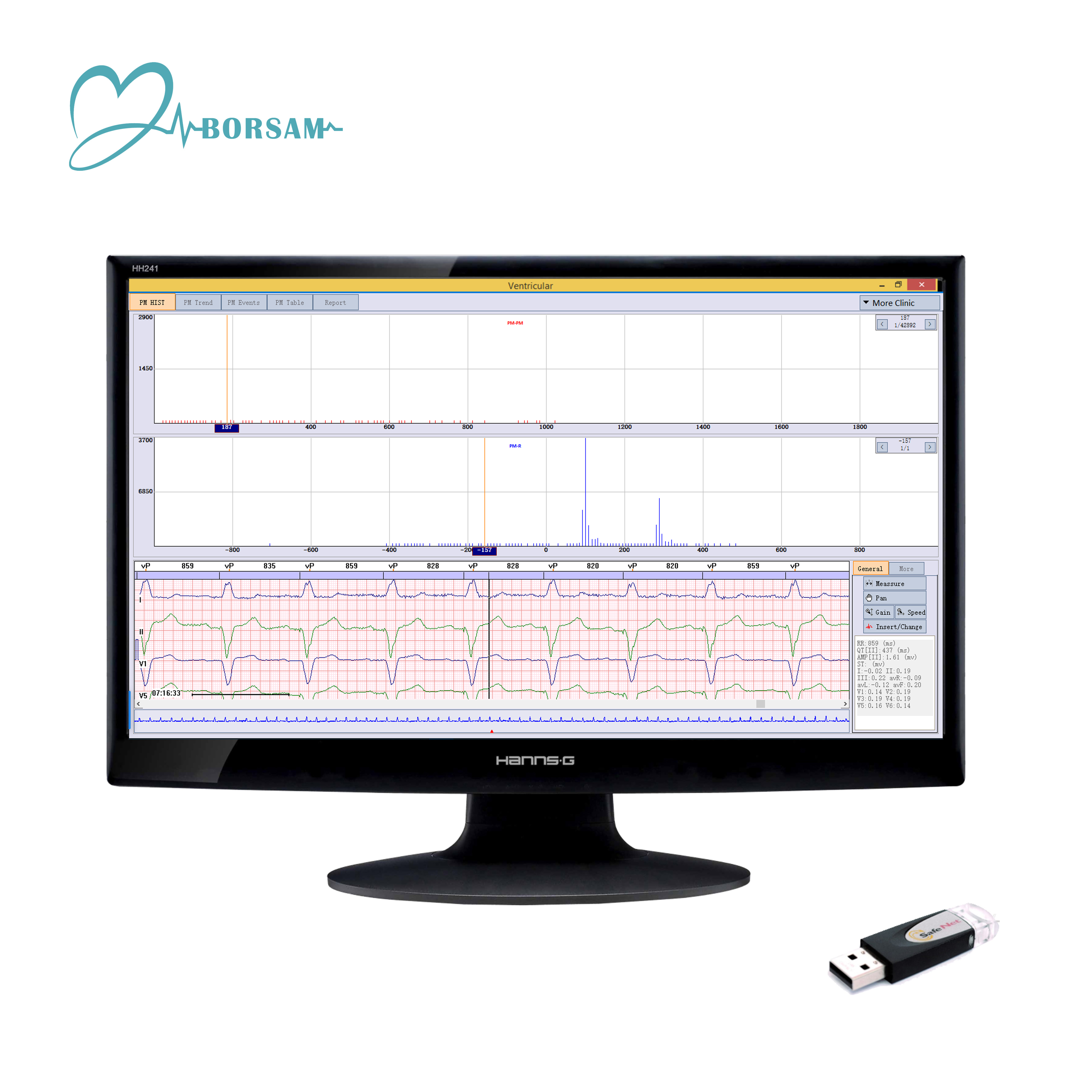 Dynamic Cardioscan Holter ECG Analysis Software