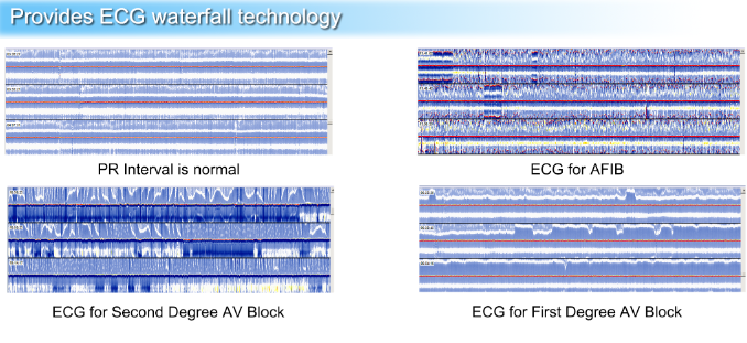 Ipad 12-Lead 3 Leads ECG 12 Channel ECG Holter Monitoring System