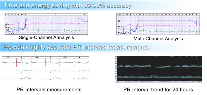 Ipad 12-Lead 3 Leads ECG 12 Channel ECG Holter Monitoring System