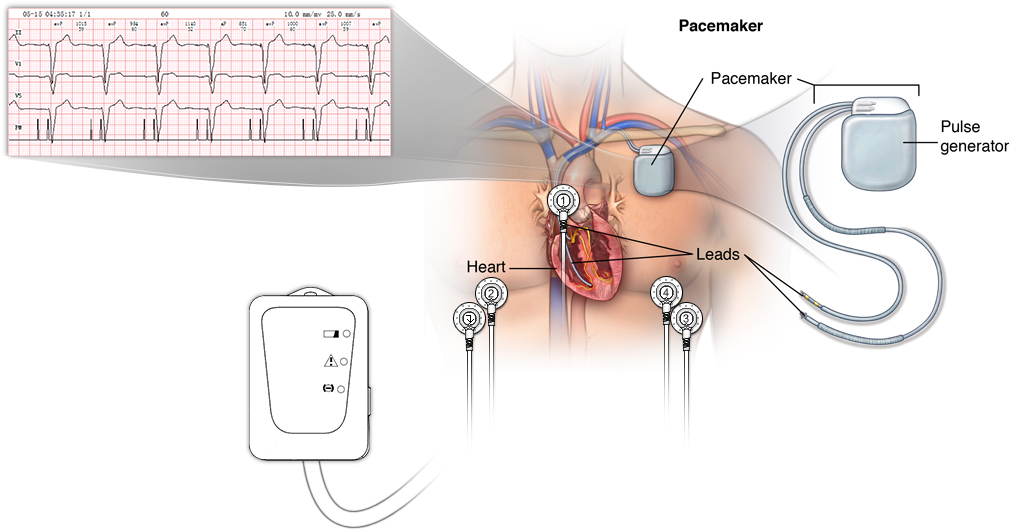 CE IOS Approved Electrocardiograph Portable 24h ECG Holter Machine