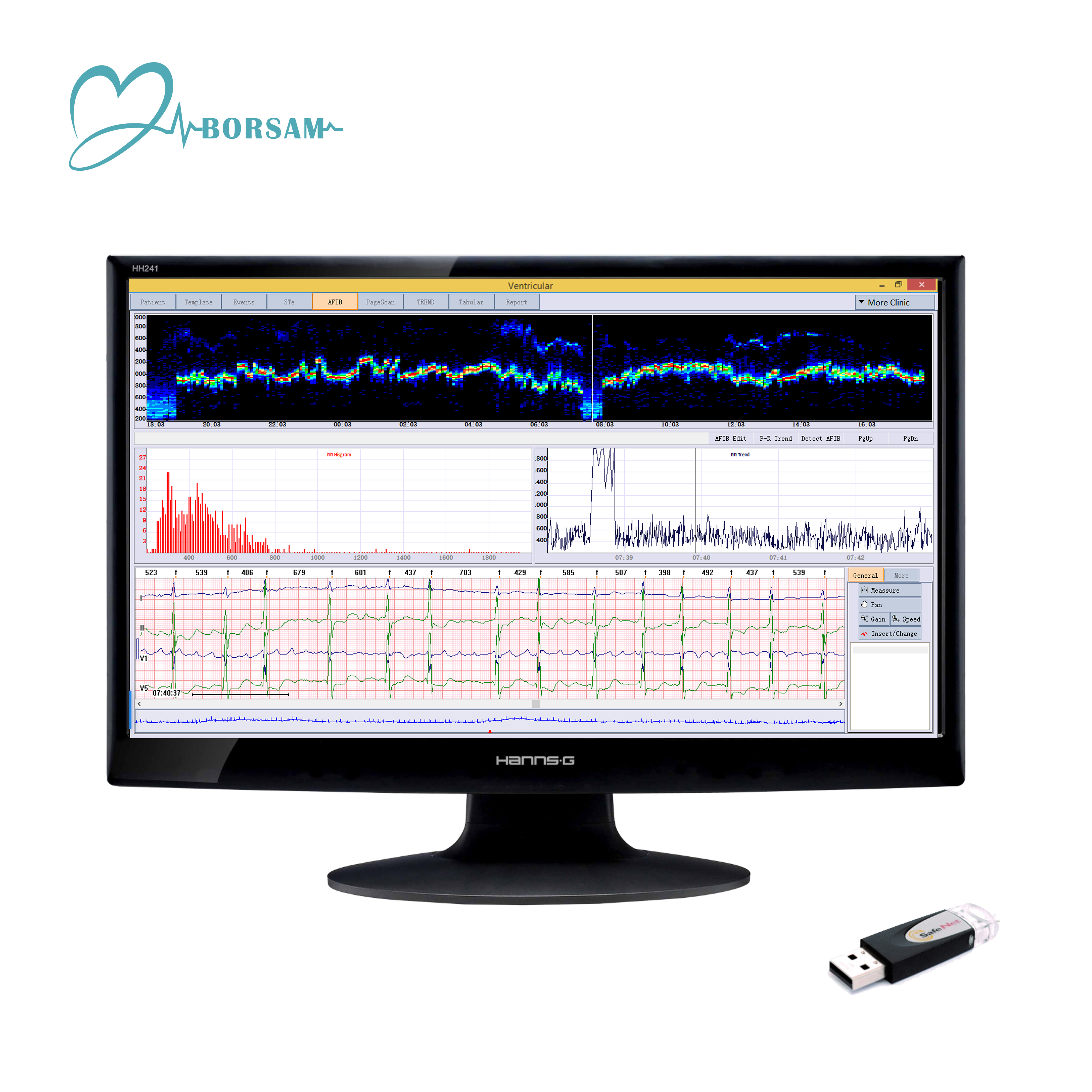 Dynamic Cardioscan Holter ECG Analysis Software