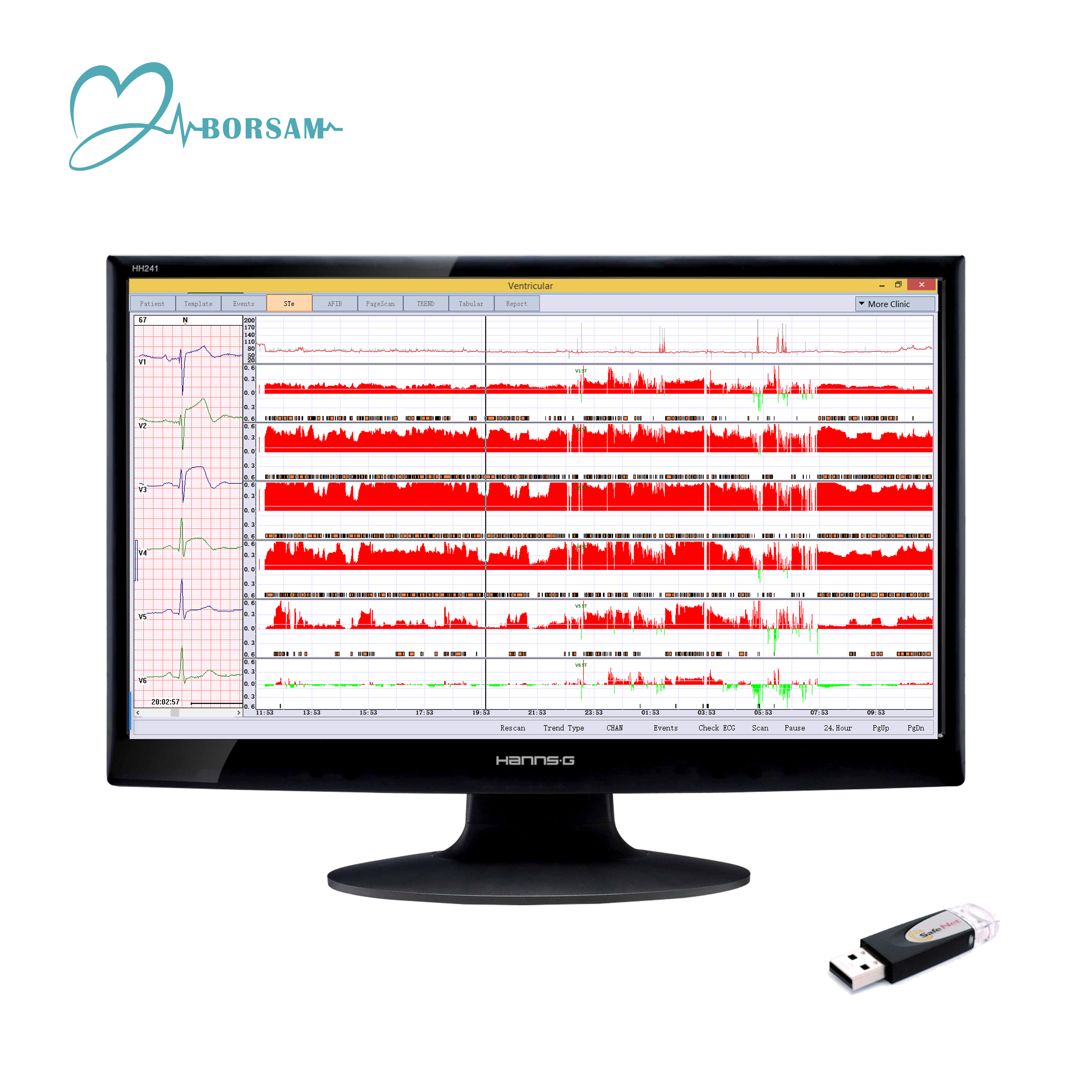Cardioscan 12 Channel  24 Hour ECG Holter Monitoring System