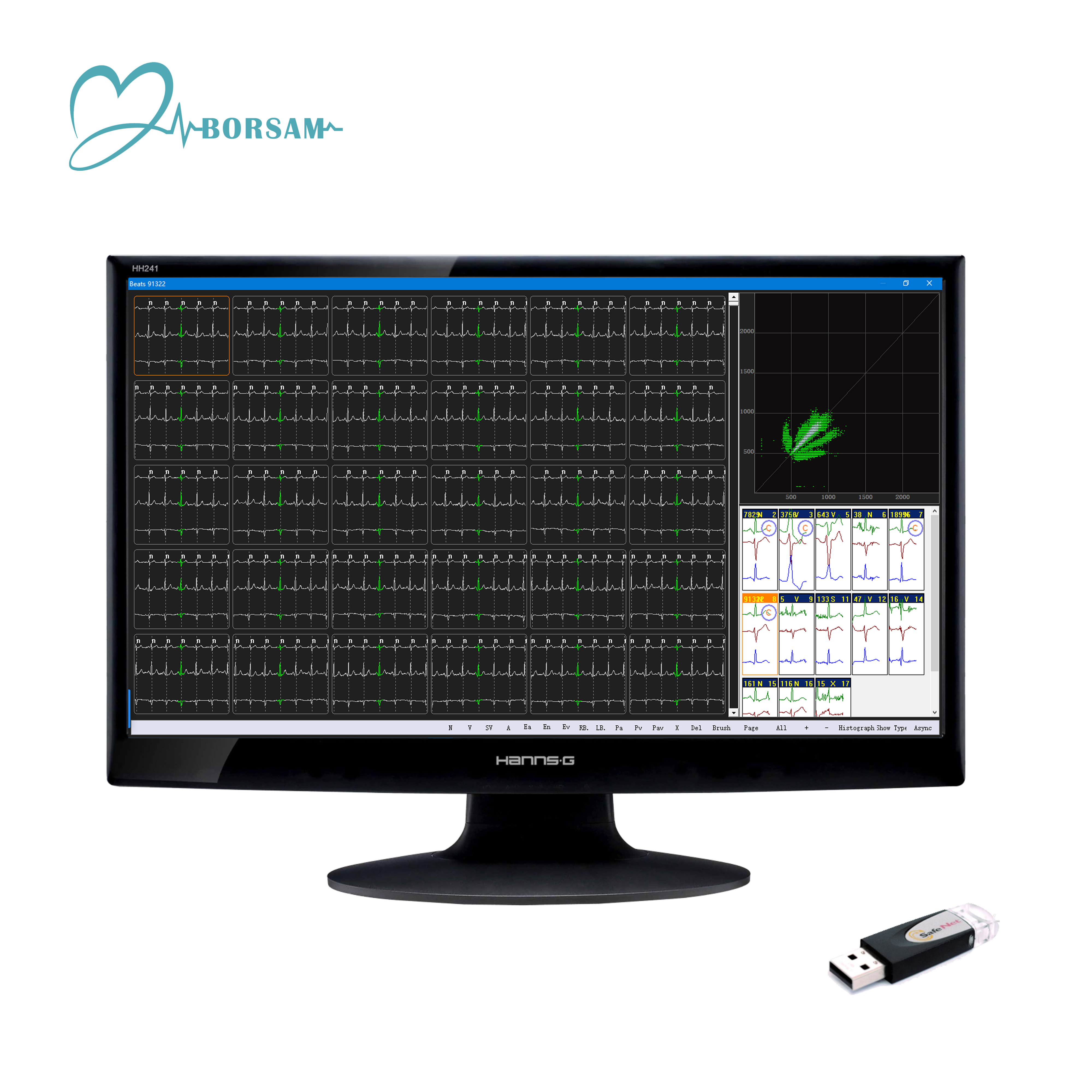 Cardioscan 12 Channel  24 Hour ECG Holter Monitoring System